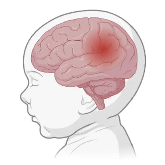 Multidimensional Video-based Contactless Infant Seizure Monitoring