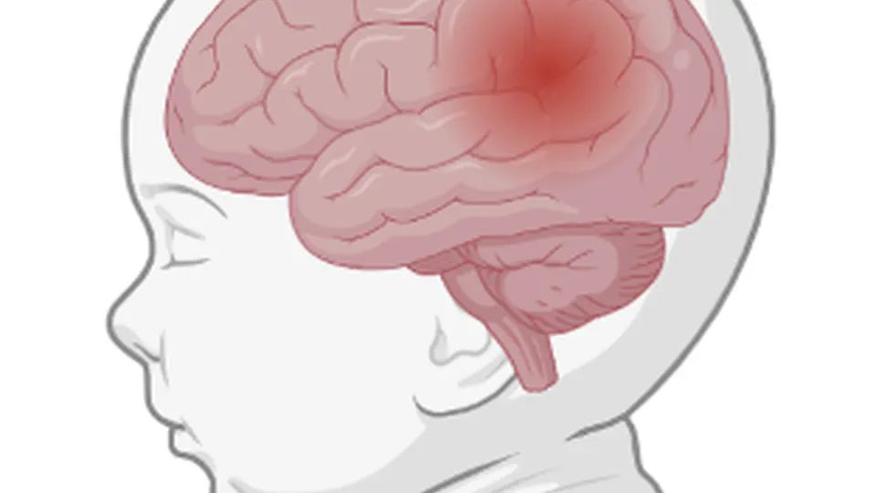 Multidimensional Video-based Contactless Infant Seizure Monitoring