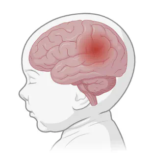Multidimensional Video-based Contactless Infant Seizure Monitoring