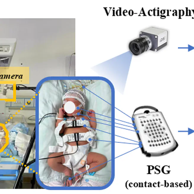 Contactless Smart Infant Sleep Monitoring System
