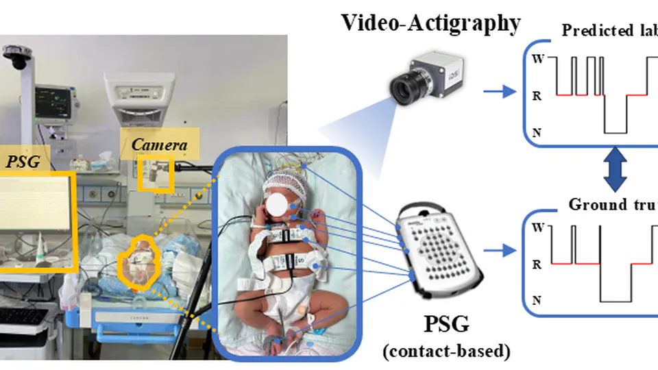 Contactless Smart Infant Sleep Monitoring System