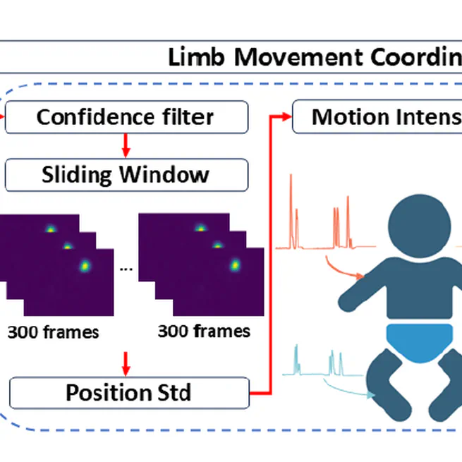 Camera-based Analysis of Motion Coordination Between Infant Left and Right Limbs: A Clinical Study in NICU.