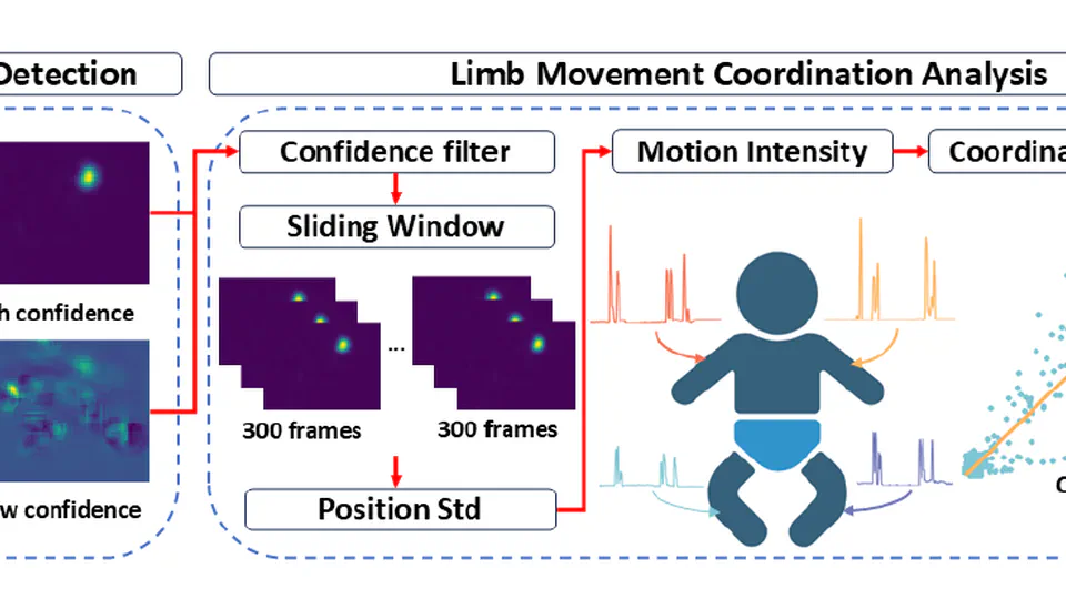 Camera-based Analysis of Motion Coordination Between Infant Left and Right Limbs: A Clinical Study in NICU.